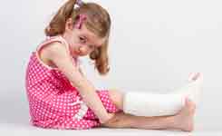 Перелом руки, ноги. Що робити?